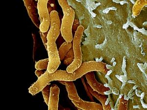 9-helicobacter-pylori-bacteria-sem-