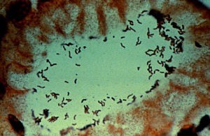 Dockat-helicobacter-pylori-2_500